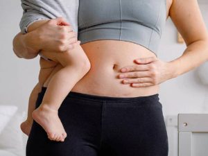 بارداری-بعد-از-جراحی-زیبایی-شکم-