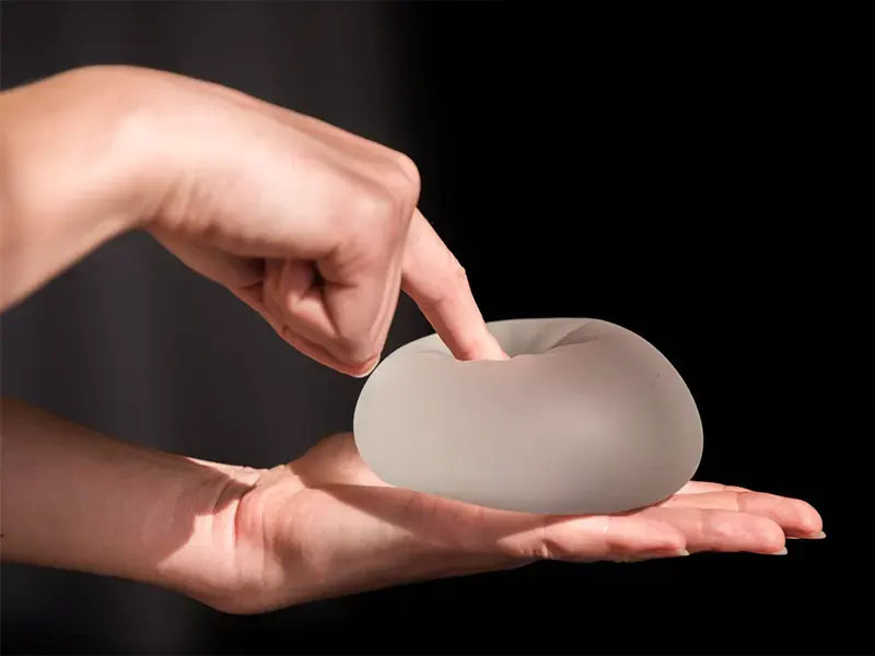 ماندگاری پروتز سینه