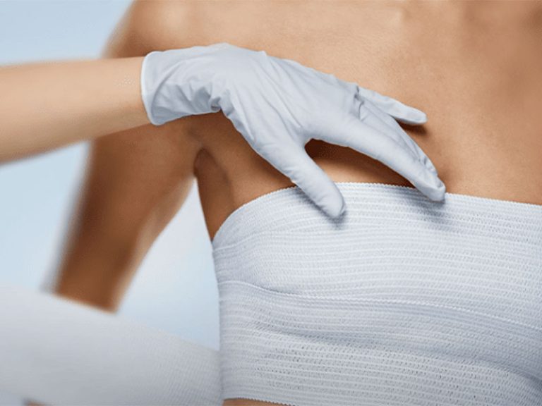 مراقبت‌های بعد از پروتز سینه