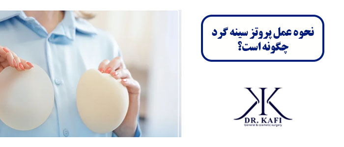 نحوه عمل پروتز سینه گرد چگونه است؟