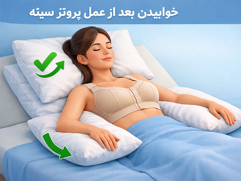 خوابیدن بعد از عمل پروتز سینه