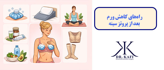 راه‌های کاهش ورم بعد از پروتز سینه