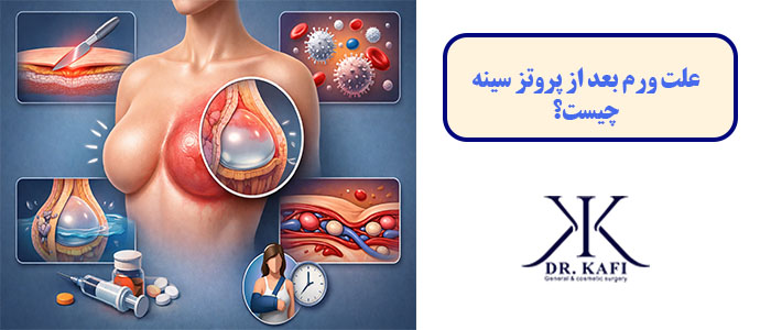 علت ورم بعد از پروتز سینه چیست؟