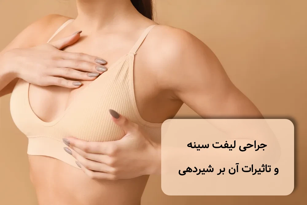 شیردهی بعد از لیفت سینه