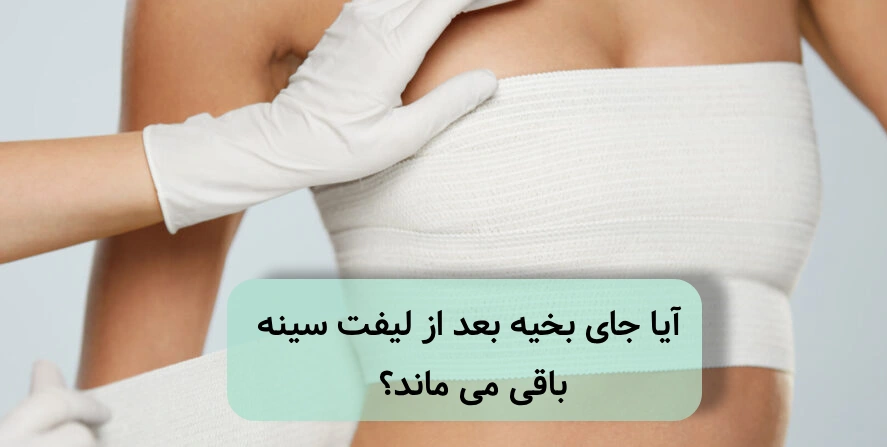 جای بخیه بعد از عمل لیفت سینه