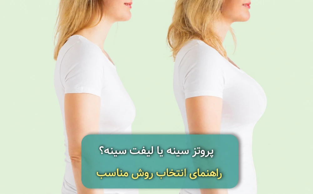 تفاوت پروتز سینه و لیفت سینه